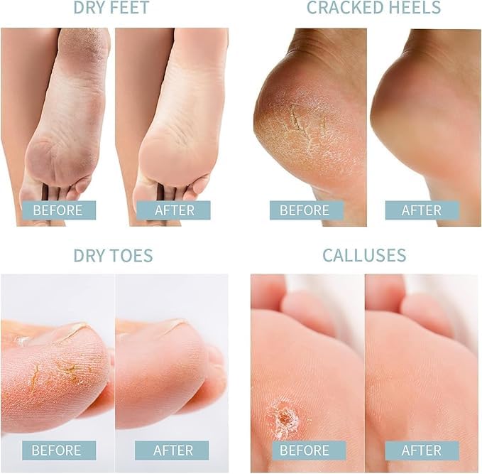 Coconut Foot Mask
